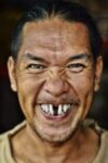 cheerful-man-with-missing-tooth-smiling-widely