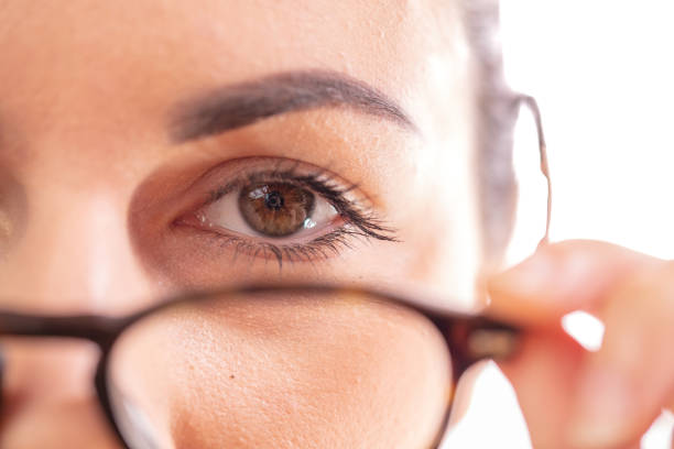 Close up of young woman dry eye syndrome