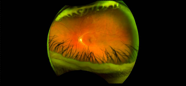 eye's retinal angle image with macula, vessels and optic disc isolated view on a black bacground. made by ultra wide fundus camera