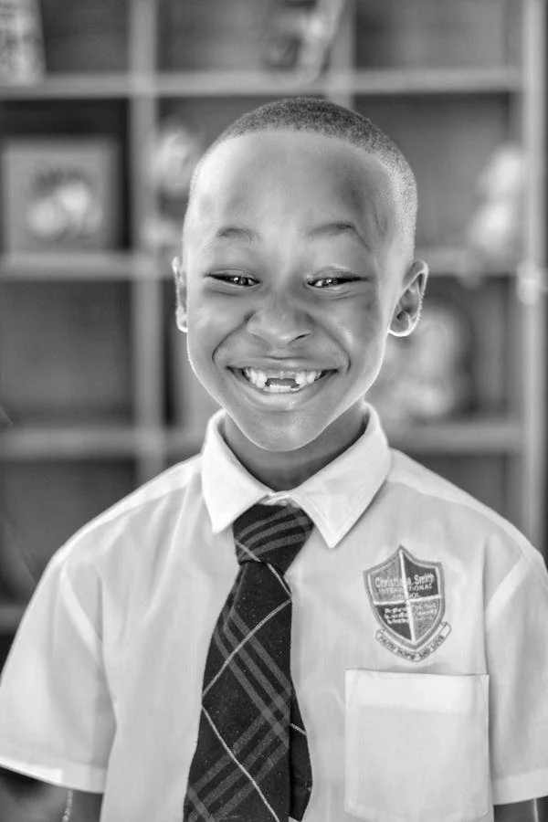 A child boy showing his Adentia teeth