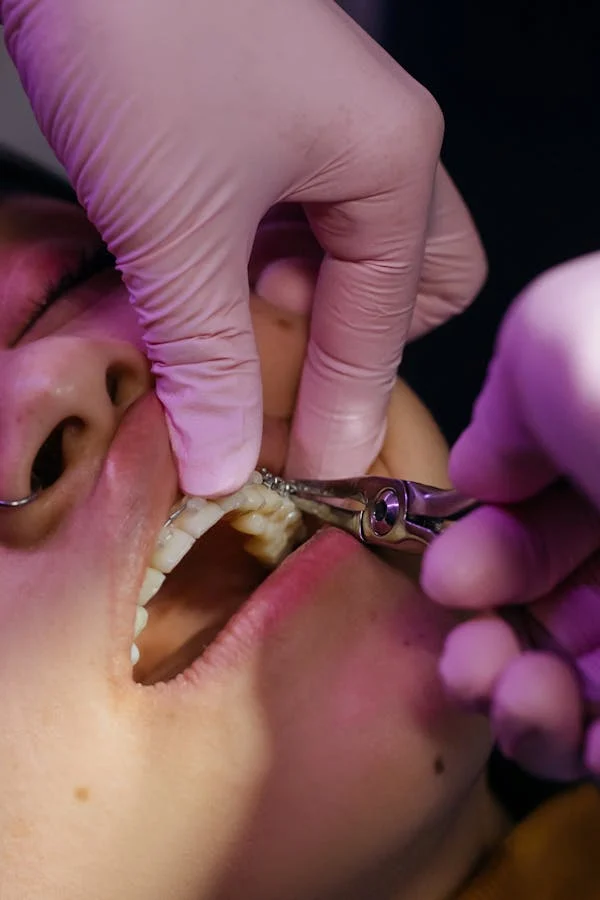 A doctor is treating Tooth dislocation