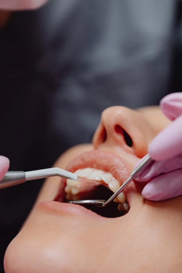 doctor treated Alveolitis