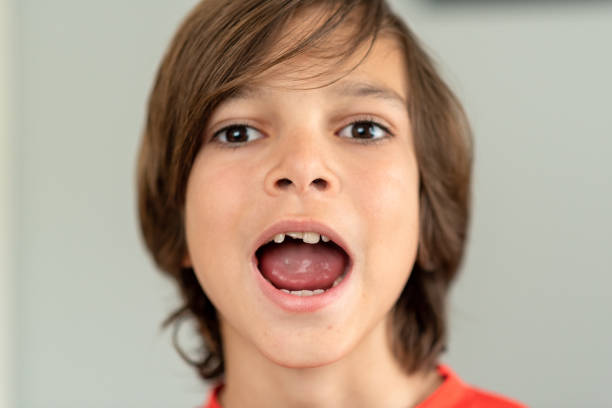 portrait of a boy with one of his front teeth broken off