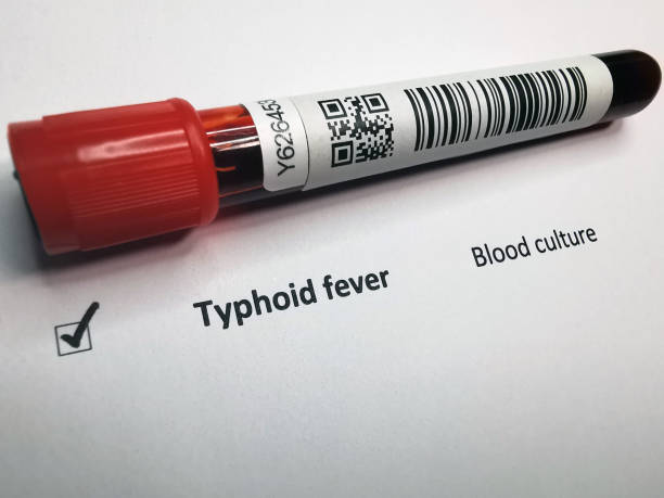 The image shows a blood test tube labeled for Typhoid Fever, suggesting it's used for blood culture tests. The test tube has a red cap and a barcode, indicating it is ready for laboratory use to diagnose Typhoid fever.