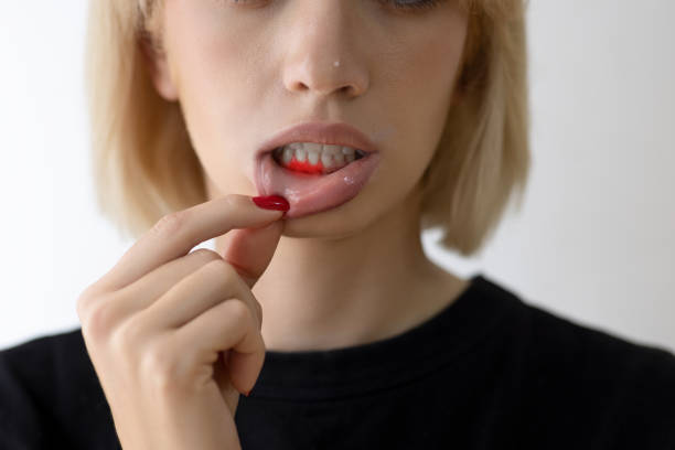 Woman showing inflamed gums, wearing black shirt and brown hair and hold her lip down